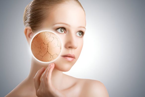 Tips for Managing Dry Skin